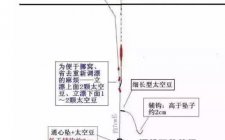 野钓通线双钩钓组的应用技巧